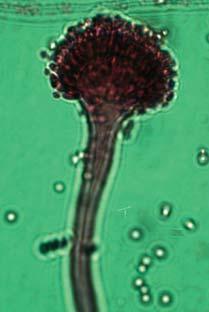 Aspergillus