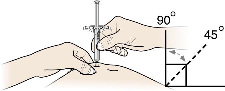 F. Nyp ihop huden runt injektionsstället för att få en spänd yta.