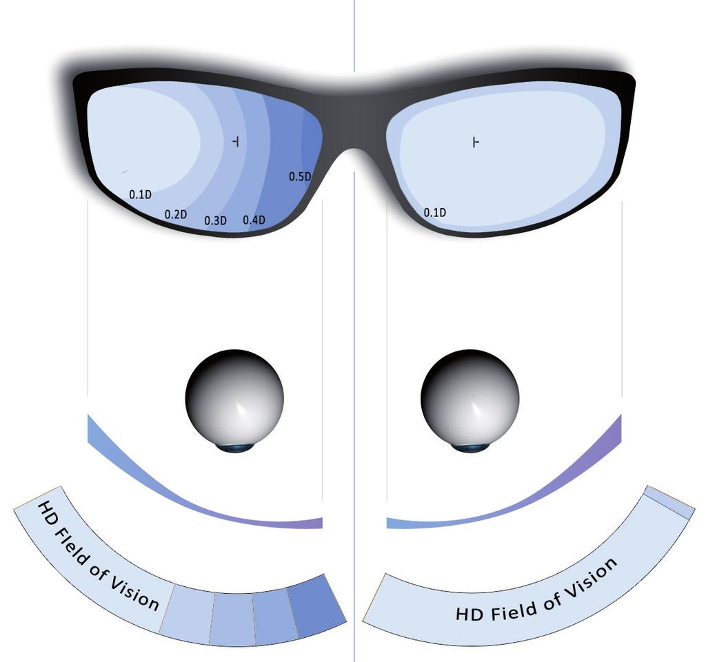 Det möjliggörs genom ett brett avståndsfält med minimala nivåer av oönskad astigmatism i periferin.