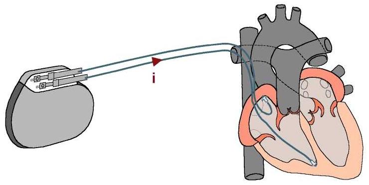 Inos 2+ CLS - Measures Cardiac Contraction with