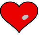 HJÄRTINFARKT / INSTABIL ANGINA EKG, iv nål, alla injektioner ges iv, ev rytmövervakning med defibrillator Hjärtläge vid dyspné, höjd fotända vid chock.