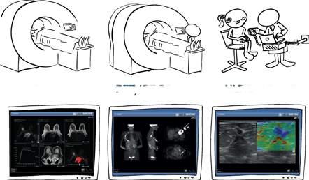 18 VERKSAMHETSOMRÅDE IMAGING IT SOLUTIONS Hur Sectra bidrar till bättre vård av patienter som Anna Det här är Anna. Hon blev nyligen diagnostiserad med bröstcancer. Hennes liv har ställts på ända.