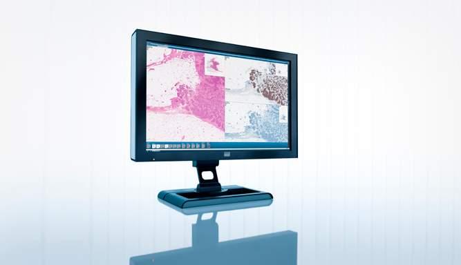 Inom Imaging IT Solutions är ett av dessa pato logi, där digital hantering av mikroskopi bilder kan effektivisera och förbättra cancervården.