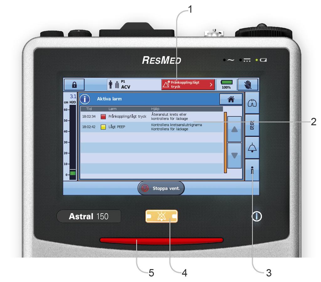 Larm Larm Astral-enheten aktiverar larm för att varna dig om förhållanden som kräver din uppmärksamhet för att garantera patientsäkerhet.