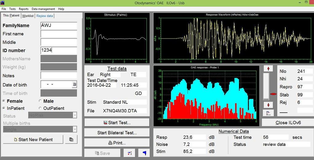 Figur 1. Diagnostiskt TEOAE från Otodynamics ILOv6 Figur 2. Screening-TEOAE från Otodynamics EZ.Screen. TEOAE som screeningtest är snabbt, enkelt, smärtfritt och kostnadseffektivt men har också begränsningar.