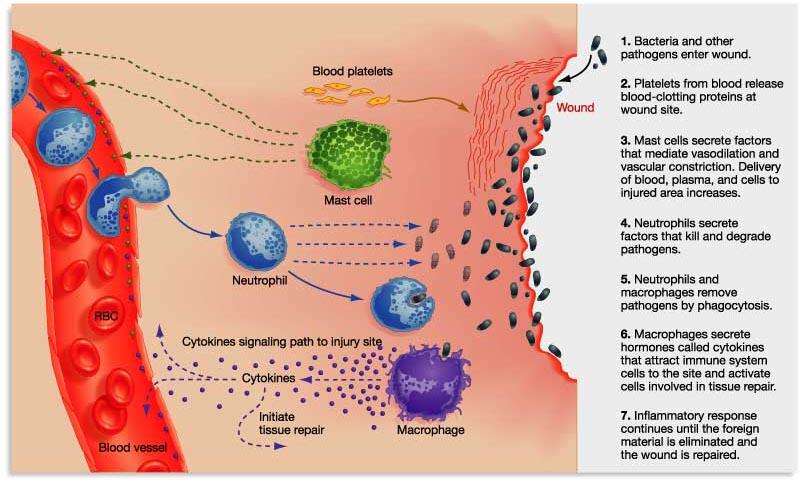 Somatisk inflammation