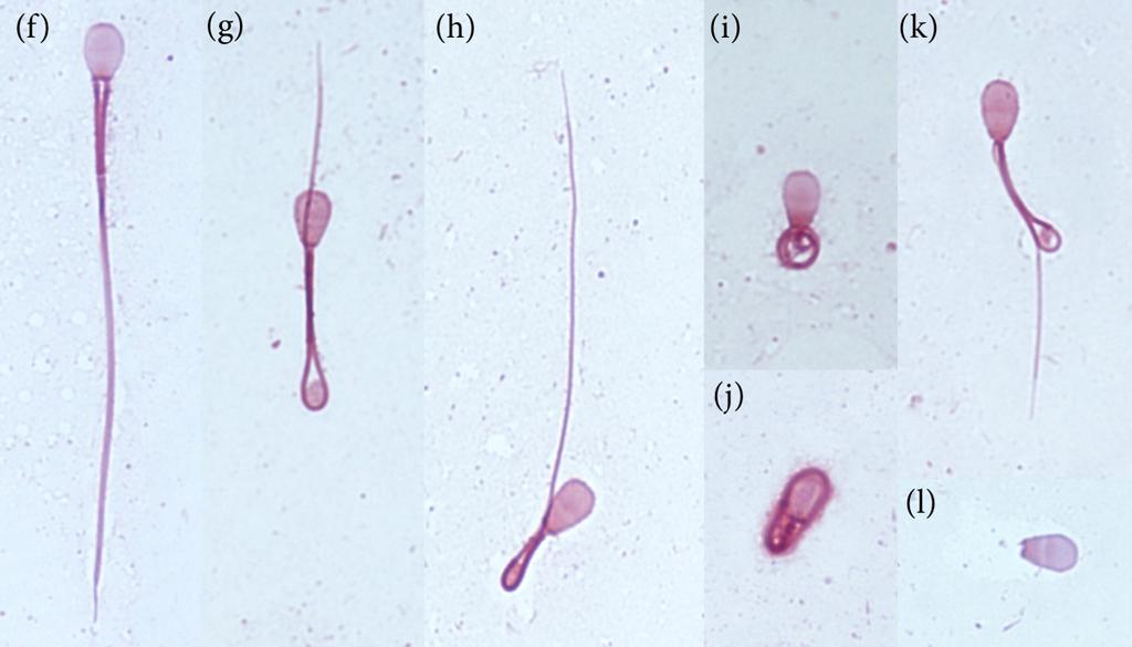 Testikelvolymen räknades ut via formeln för en ellipsoid; (l) x (h) x (b) x 0,5236. Spermiemorfologi Bedömning av spermiekvalitén gjordes med avseende på spermiemorfologin.