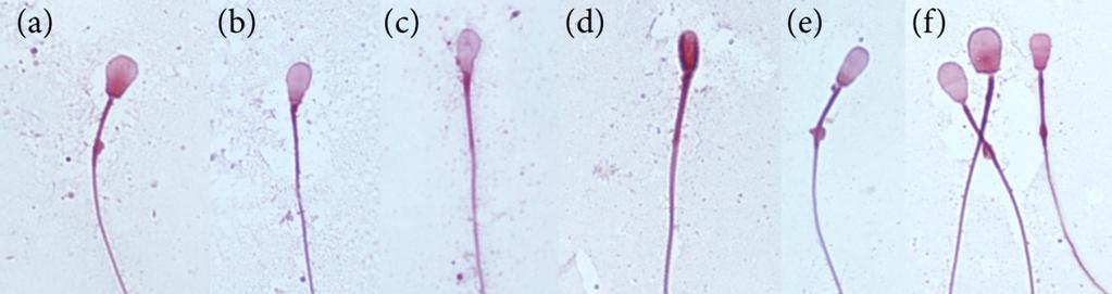 Figur 3. Exempel på olika defekter på spermiehuvudena, bilderna är tagna i williamfärgning.