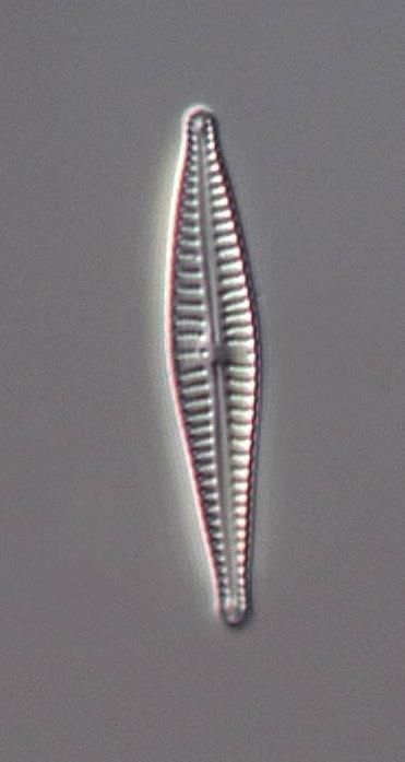 subcapitata, Psammothidium abundans, Stauroforma exiguiformis (Figur 8) och Tabellaria flocculosa.