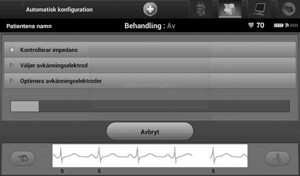 5. När Automatisk konfiguration har startats sker följande: Enhetskontroll av chockelektrod för att mäta elektrodimpedans. Normalt impedansintervall under tröskelvärdet är < 400 ohm.