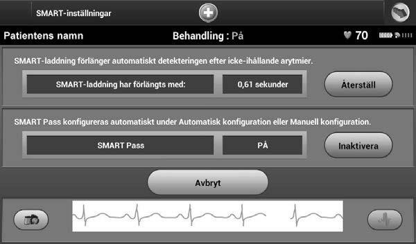 SMART-inställningar På skärmen SMART-inställningar kommer användaren åt information och funktionerna SMARTladdning och SMART Pass.