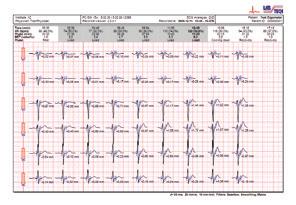Ord. pris 22.900:- Kampanjpris 18.900:- (monitor, standardmanschett, väska, seriellt eller USB interface (optiskt) för PC och CardioVisions, personlig version). 3110 Nätverkslicens (5 anv.