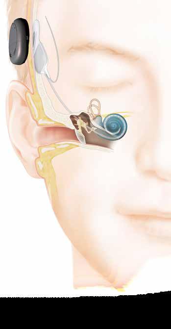 KANSO syns inte 1 2 12 4 3 Hörselgång Hörselben Trumhinna Cochlea (inneröra) 1 Kanso fångar in ljud och omvandlar det till digital kod.