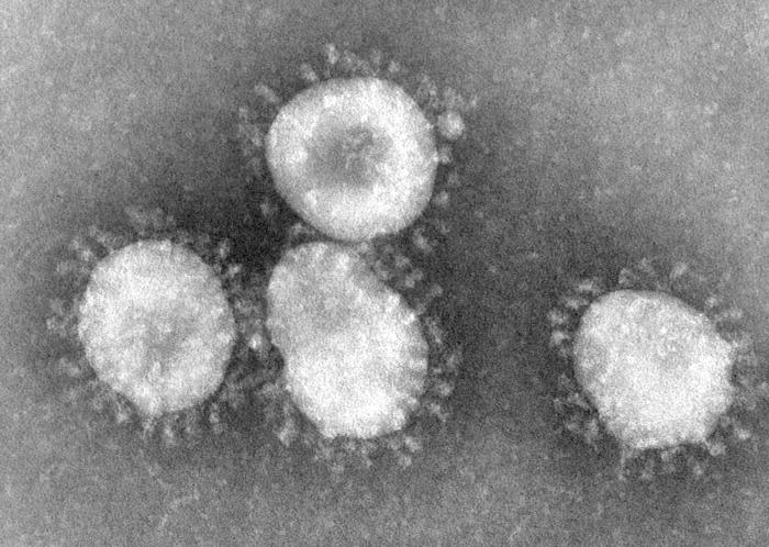 långsmal TMV Rabies Paramyxovirus