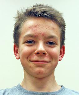 Johan Andersson BK Marbo Längd: 170 cm Räckvidd: 174 cm Räckhöjd: 220 cm Oscar Halleröd Mölndal BK Längd: 190 cm