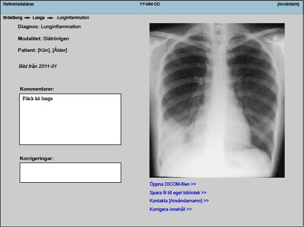 Bilaga 6: Skiss av gränssnittet integrerat i PACS Filbiblioteket i PACS