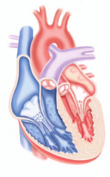 زندگی با فیربیالسیون دهلیزی و خطر ابتال به سکته مغزی در حالت طبیعی قلب رضبان منظمی دارد.