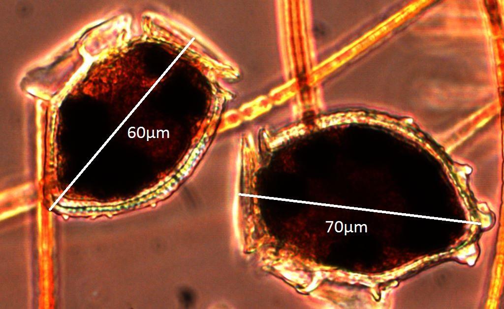 Figur 5.8. Under sommaren 212 förekom en mer storcellig variant av dinoflagellaten Dinophysis norvegica, som inte har återfunnits på stationen sedan 199.