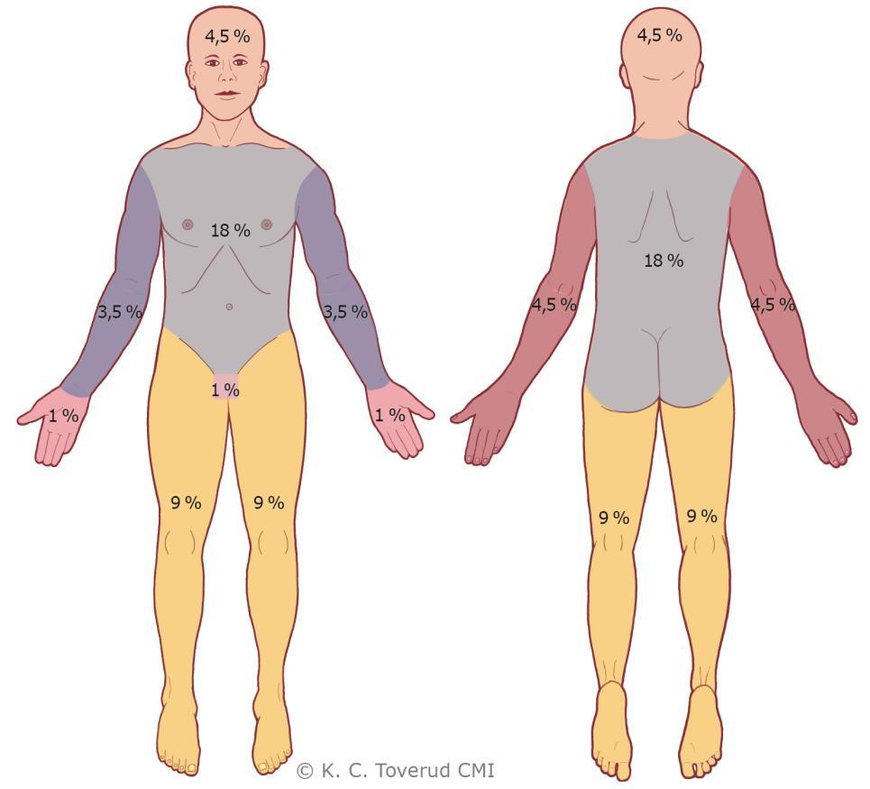 TRAUMA 63 Differentialdiagnoser Differentialdiagnostiken utgör sällan något problem men vid total avsaknad av anamnes kan delhudsbrännskador behöva skiljas från t.ex.