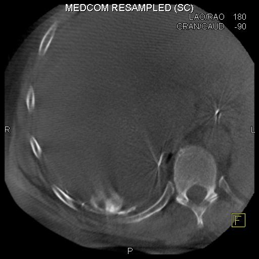 Cone Beam CT