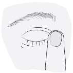 5. Efter att ha använt Chloramphenicol Pharmathen ögondroppar tryck med ett finger i den inre ögonvrån vid näsan i 2 minuter. På så sätt undviker du att lösningen tas upp i resten av din kropp. 6.