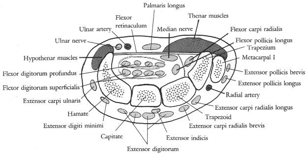 Figur 6* I mån av tid så dissekeras nu thenar- och hypothenarmusklerna. Ytligast av thenarmusklerna ligger m. abductor pollicis brevis. Vid den laterala kanten ses m.