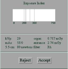 Reproducerbarheten ± 5% av medeldosen Dos output, dos-mas linjäritet och exp.tid [EUREF 2b.2.1.1.5], [EUREF 2b.2.4.