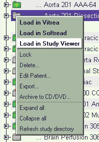 Study Viewer Med funktionen Study Viewer kan du förhandsgranska skannade bilder från CT, MR, NM, PET, US, CR, DR och bilder i SC-format (secondary capture).