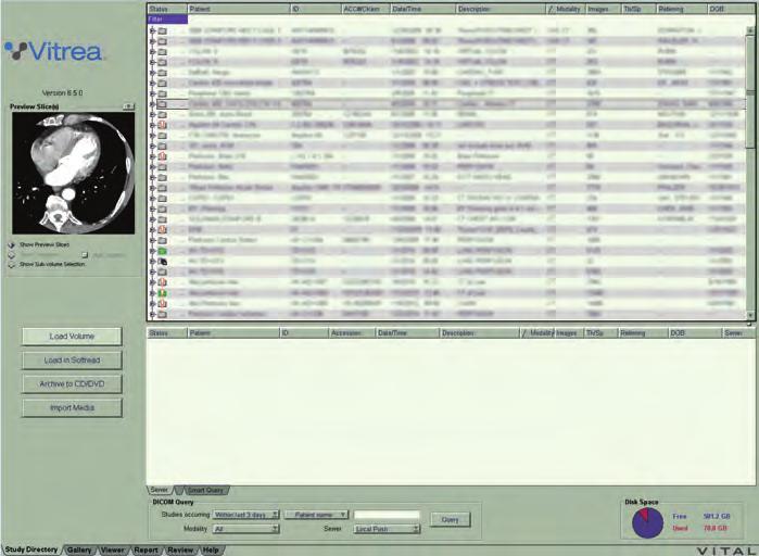 Study Directory (studiekatalog) i VitreaWorkstation 1 2 4 3 6 5 8 7 Bildtextnummer Beskrivning 1 Programvaruversion 2 Förhandsgranskningsruta 3 Inläsningsknappar 4 Patientlista 5 Område för