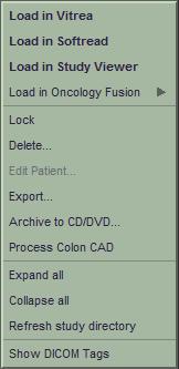 Högerklicksmeny Högerklicka i patientlistan och välj sedan i den meny som visas om du vill läsa in eller hantera patientstudier.