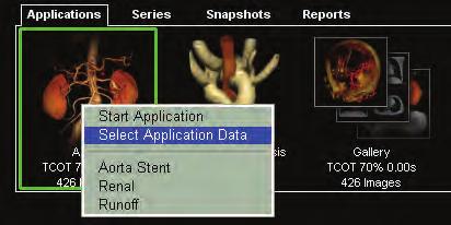 Med datahanteraren kan du: läsa in en studie i ett program läsa in en eller flera serier i antingen 2D- eller 3D-visningsverktyg skicka en serie eller studie till en DICOM-enhet (se DICOM-avsnittet)