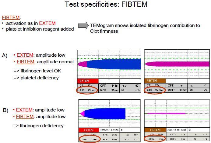 FIBTEM: test med och