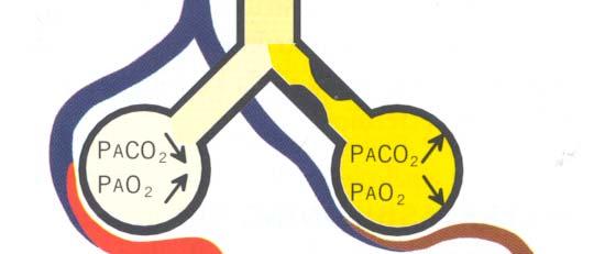 Diffusionsskada PAO 2 PACO 2 PAO 2 PACO 2 O 2 CO 2 O 2 CO 2 PaO 2 PaCO 2 Typer av funktionssvikt Andningsregl.