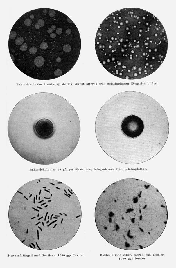 316 Frans Lundgren Visualiserings- och reproduktionstekniker som del av det kulturella framsteget. Fotografier av bakteriekulturer återgivna i E.