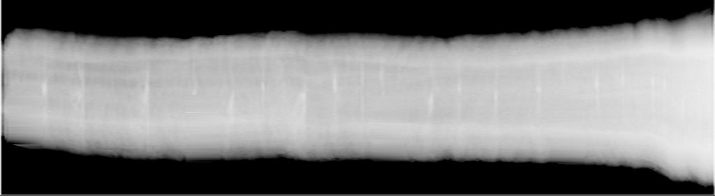 0101119.doc 010-11-19 14 (56) Figur 4: Industriell röntgenbild av en furustock (övre) och gångvägskompenserad röntgenbild av samma stock (nedre).