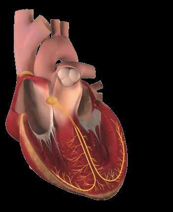 En pump och elcentral Vad är hjärtsvikt? En normal hjärtrytm innebär att hjärtat Hjärtats sammandragningar styrs av slår 50 till 100 slag per minut.