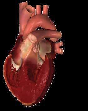 Det gör att hjärtat inte orkar dra ihop sig normalt och därför inte kan pumpa ordentligt.