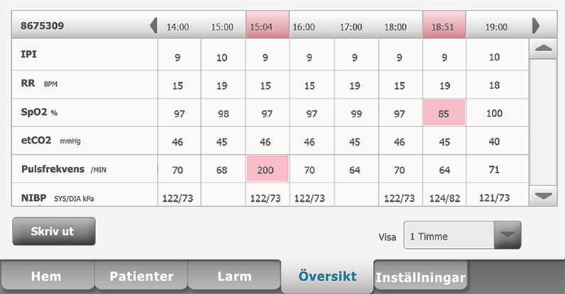 Anm Mätningar som utlöste ett fysiologiskt larm är markerade på den här fliken. 2. Tryck på listrutan Visa för att modifiera trendintervallet. Standardtrendintervallet är 1 minut. 3.