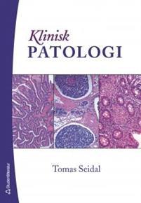 Klinisk patologi PDF ladda ner LADDA NER LÄSA Beskrivning Författare: Tomas Seidal. Ämnet klinisk patologi handlar om morfologisk diagnostik av cell- och vävnadsprover.