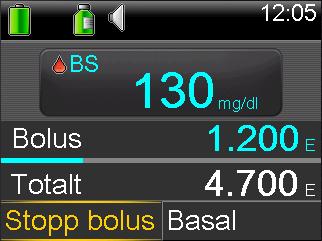 Observera: Här beskrivs hur man stoppar en pågående bolus. Detta stoppar inte din dosering av basalinsulin.