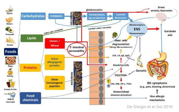 Kostfaktorer och symtom vid IBS De Giorgio et