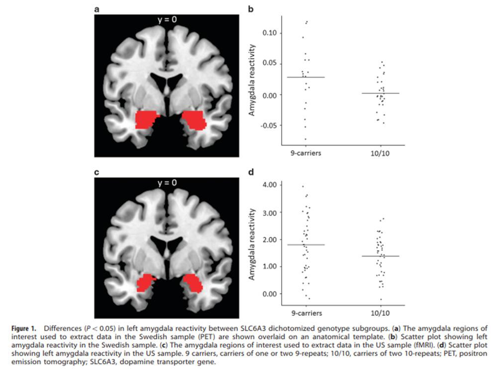 DOPAMINTRANSPORTÖREN Projektioner amygdala - nucleus