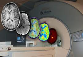 personlighetsdrag Interaktion serotonin-dopamin?