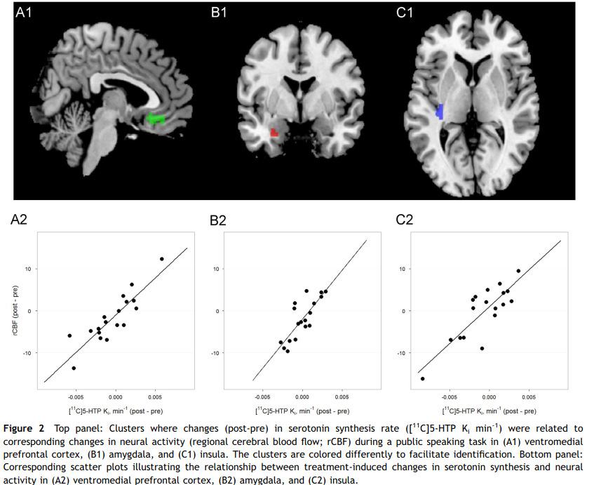 GG) tidigare associerad med: - högre reaktivitet i amygdala -