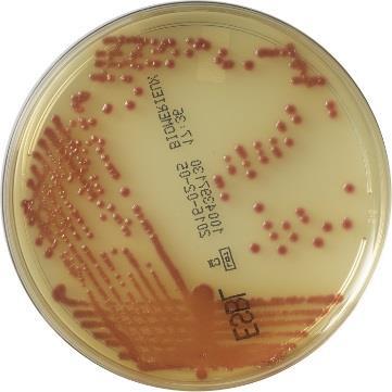 Campylobacter, EHEC O157 Särskilda plattor/antibiotikalappar vid ESBL-screening.