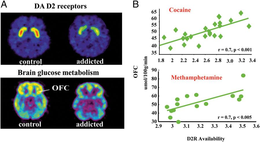 protein, K kanaler, NMDA receptorer mm Förändrat uttryck av transmittorsubstanser ger obehag Uppreglering av dynorfin, CGRP