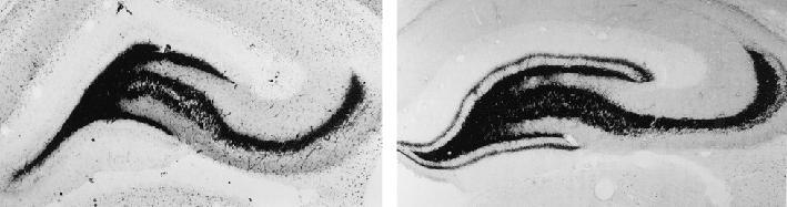 Is Being Plastic Drastic.Or Fantastic??? Mossy fiber sprouting after developmental seizures is associated with subsequent epilepsy.