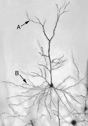 network activation Cazalis F, et al.