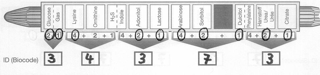 (A) (B) Figur 6: BBL Enterotube II resultatblock (A= databas med VP; B= databas utan VP) Tabell 1: Negativa och positiva reaktioners utseenden i BBL Enterotube II REAKTIONER ANMÄRKNINGAR Reagenser