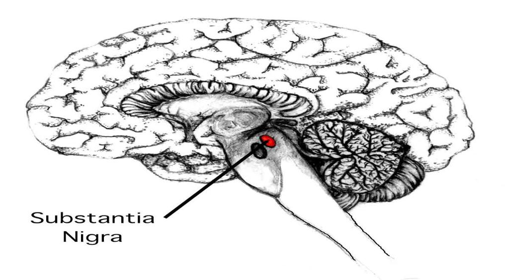 Primärt degenarativa Degeneration av substantia nigra, nervcellerna som producerar